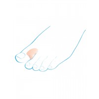 Межпальцевые ортопедические разделители Крейт С-400