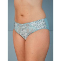 Трусы Lady Lux 0048-214 Эдельвейс Трусы Lady Lux 0048-214 Эдельвейс