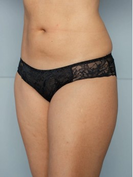 Трусы Lady Lux 0269-180 Черный