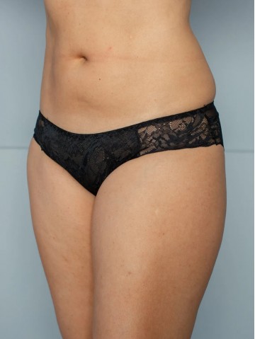 Трусы Lady Lux 0269-180 Черный